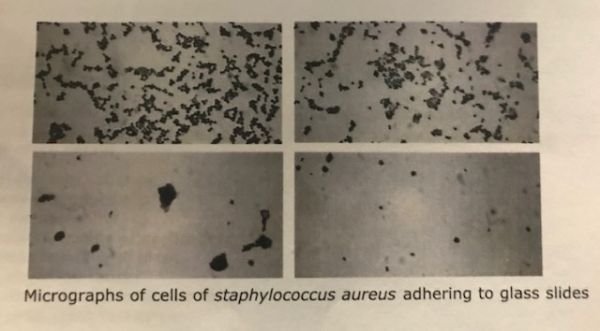 Easy-Clean X-Ray Glass Before and After Treatment