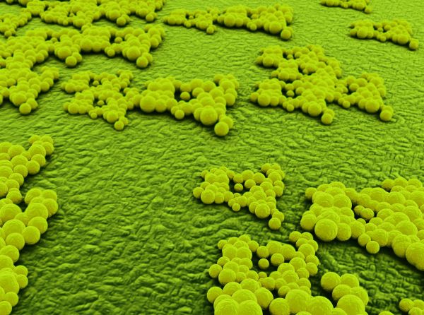 Microbes on Hard Surfaces
